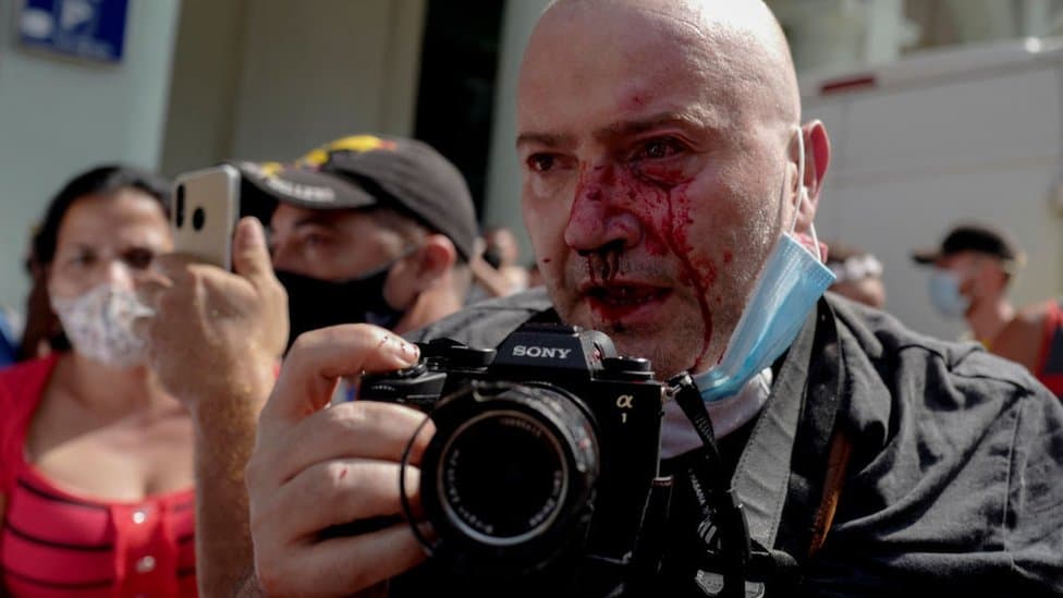 A photojournalist injured while covering demonstrations